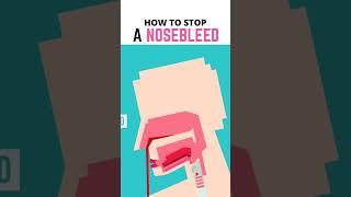 How Do You Actually Stop a Nosebleed? #shorts #education