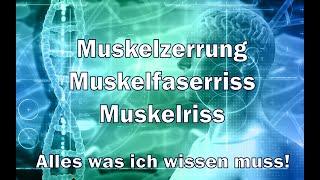 Muskelzerrung I Muskelfaserriss I Muskelriss Alles was ihr wissen müsst!!