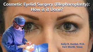 Blepharoplasty (Cosmetic Eyelid Surgery) - See How It's Done