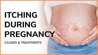 Is it normal to be itchy during pregnancy? | Itching during pregnancy | iMumz