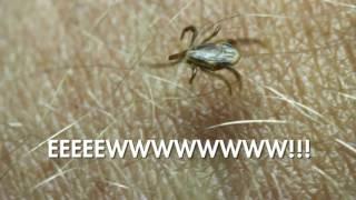 Physicians Urgent Care - Ticks :15sec