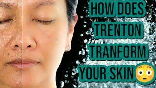 What Does Tretinoin Does To Your Skin?