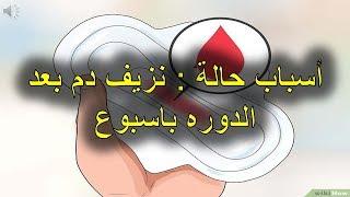 أسباب حالة   نزيف دم بعد الدوره باسبوع