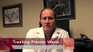 How to Get Rid of Plantar Warts