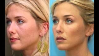 The difference between Botox or Dermal Fillers & how they work? The Medical Skin Clinic