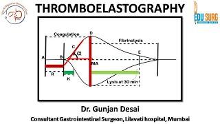 Thromboelastography - TEG coagulation test explained, interpretation of TEG Graph - Edusurg Clinics
