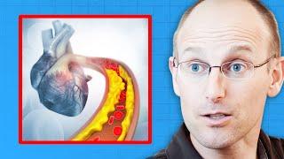 Cardiologist Explains Why LDL Cholesterol Is a POOR PREDICTOR of Clogged Arteries | Dr. Bret Scher