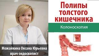 Полипы толстого кишечника. Диагностика и удаление полипов толстого кишечника.