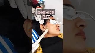  Laser Hair Removal Live Procedure | LHR Treatment | Best Skin Doctor In Delhi #shorts #shortsfeed