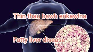 Thin thau bawh (fatty liver disease) enkawlna (@Gilead-Thinghnai)