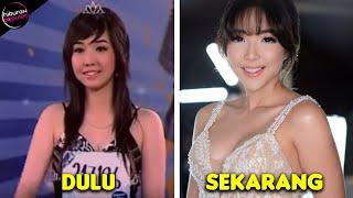 GISEL BERUBAH TOTAL! Begini Transformasi Mengejutkan Artis Sebelum dan Sesudah Veneer Gigi