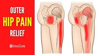 How to Fix Outer Hip Pain FOR GOOD