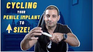 Why Cycling your Penile Implant is Important