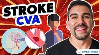 Stroke CVA (Cerebrovascular Accident) Hemorrhagic, Ischemic NCLEX RN & LPN NURSING