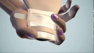 Emptying a Drainable Ileostomy Bag | Salts Healthcare