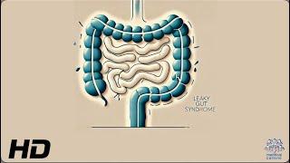 Leaky Gut Syndrome: The Silent Saboteur of Your Health!