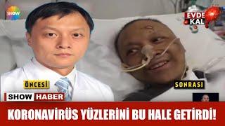 Koronavirüs yüzlerini bu hale getirdi!