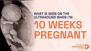 Pregnancy Week 10 Ultrasound: 4D Ultrasound and Twins