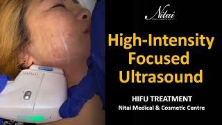 High-Intensity Focused Ultrasound - HIFU Treatment - Nitai Cosmetics Melbourne