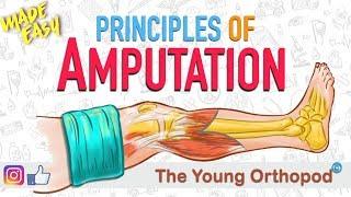 Amputation Principles | ANIMATION | BASICS | NEET PG | Amputee - The Young Orthopod