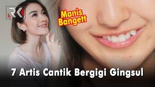 7 Artis Cantik yang Punya Gigi Gingsul, Manis Banget Pas Senyum!