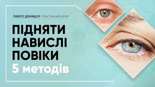 ПІДНЯТИ  НАВИСЛІ ПОВІКИ ️ 5 МЕТОДІВ + БОНУС