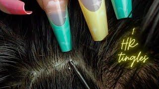 {ASMR} 1 HR + Super Attentive NITPICKING SCALP WHITEHEADS | zoomed | soft whispers