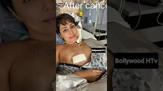 Before cancer&After cancer#hinakhan ️#bollywood#youtubeshorts️