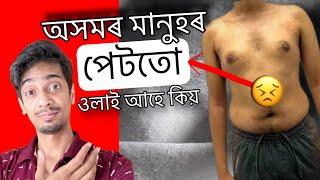 Why Indian are so Unhealthy - পেটতো ওলাই আহে কিয় - Dimpu Baruah