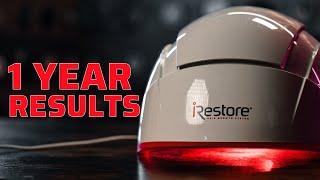 iRestore Laser Hair Growth Therapy 1 Year Test RESULTS!