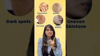 Skincare for Pigmentation and Uneven Skintone | Sunscreen for Pigmented skin | Dark Spots, Melasma