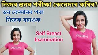 Self BREAST Examination | Breast CANCER And Breast Self-Exam | Assamese Health Video