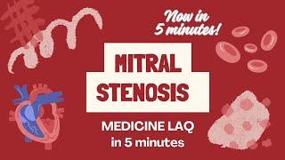 MITRAL STENOSIS MEDICINE LAQ in 5 minutes ONLY