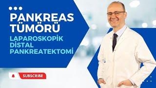 Pankreas Kanseri ve Tümörlerinde Laparoskopik Cerrahi Tedavi | Prof. Dr. Hakan Yanar