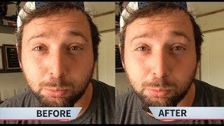 How to remove Blemish/scars/Acne in Adobe Premier Pro!