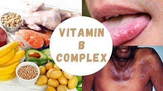 VITAMIN B COMPLEX - What is it ? | BIO CHEMISTRY | ANYTIME MEDICINE