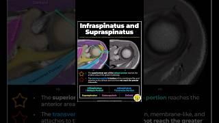 Understanding Infraspinatus Tendon Anatomy_ Key Insights for MRI