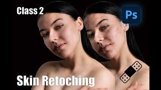 Removing BLEMISHES in Photoshop: Ultimate Skin Retouching Guide