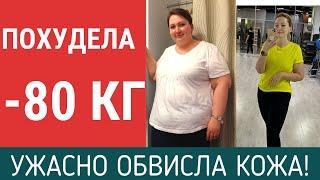 УЖАСНО ОБВИСЛА КОЖА | 6 МЕСЯЦЕВ  | РЕЗЕКЦИЯ ЖЕЛУДКА | ОТЧЕТ