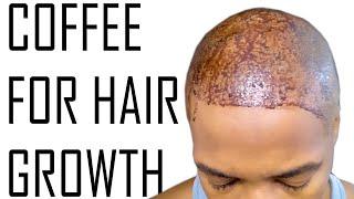 Use Regular Coffee To Accelerate Hair Growth [How I Did It]