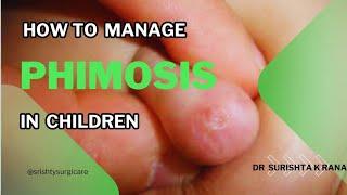 PHIMOSIS- PARTIAL CIRCUMCISION