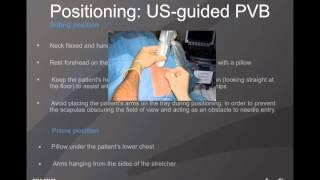 Webinar: Ultrasound-Guided Paravertebral Nerve Blocks