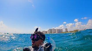 Florida man gets stung by Portuguese Man O’ War