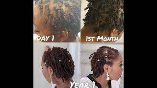 My 1 Year Loc Journey From Day 1| Low Density Locs | Thin Fine Locs | Alopecia | Loc Tips And Advice