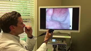 ENT flexible laryngoscopy