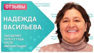 Надежда Васильева  отзыв через 2 года после all-on-6