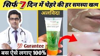 Aloe vera gel for face, Patanjali saundarya aloe vera gel review and aloe vera gel ke fayde|in 2023