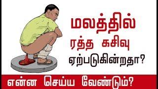 மலத்தில் ரத்த கசிவு ஏற்படுகின்றதா?| Blood in Stool | Rectal Bleeding | Tamil tips