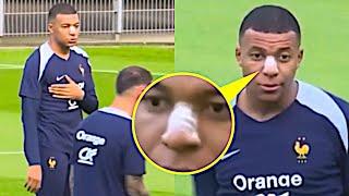 Mbappe Back in Training After he Broke His Nose