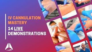 Intravenous (IV) cannulation compilation with demonstration of 14 procedures